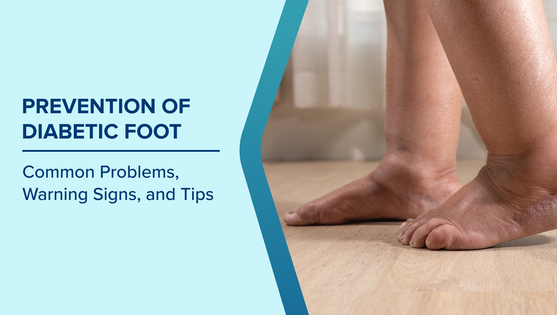 The Ultimate Guide: Prevention and Care of the Diabetic Foot