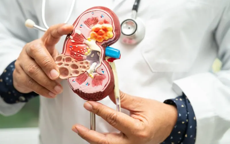 Nephrology in Kukatpally | Chiranjeevi Hospitals