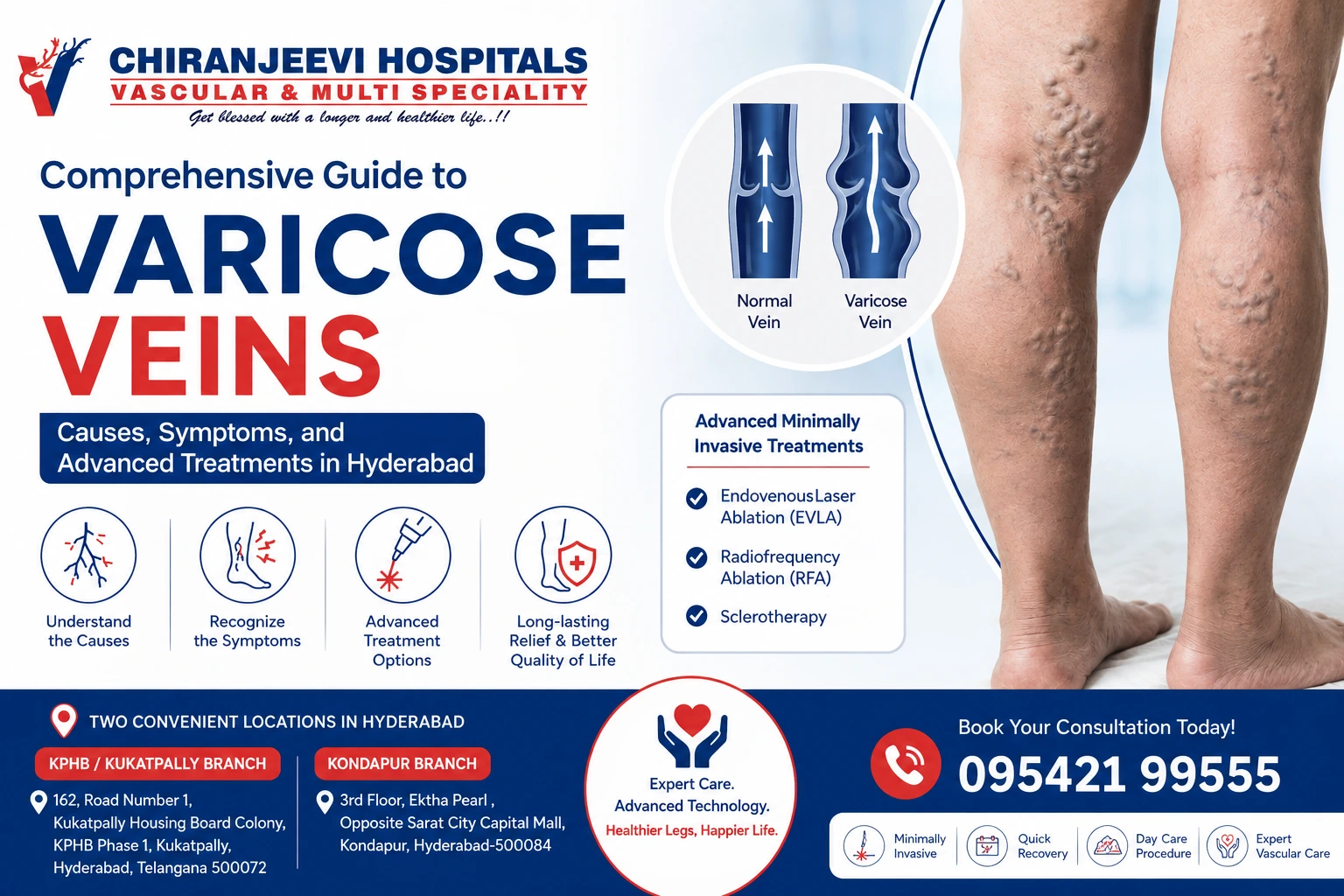 Varicose Veins Treatment in Hyderabad | Chiranjeevi Hospitals