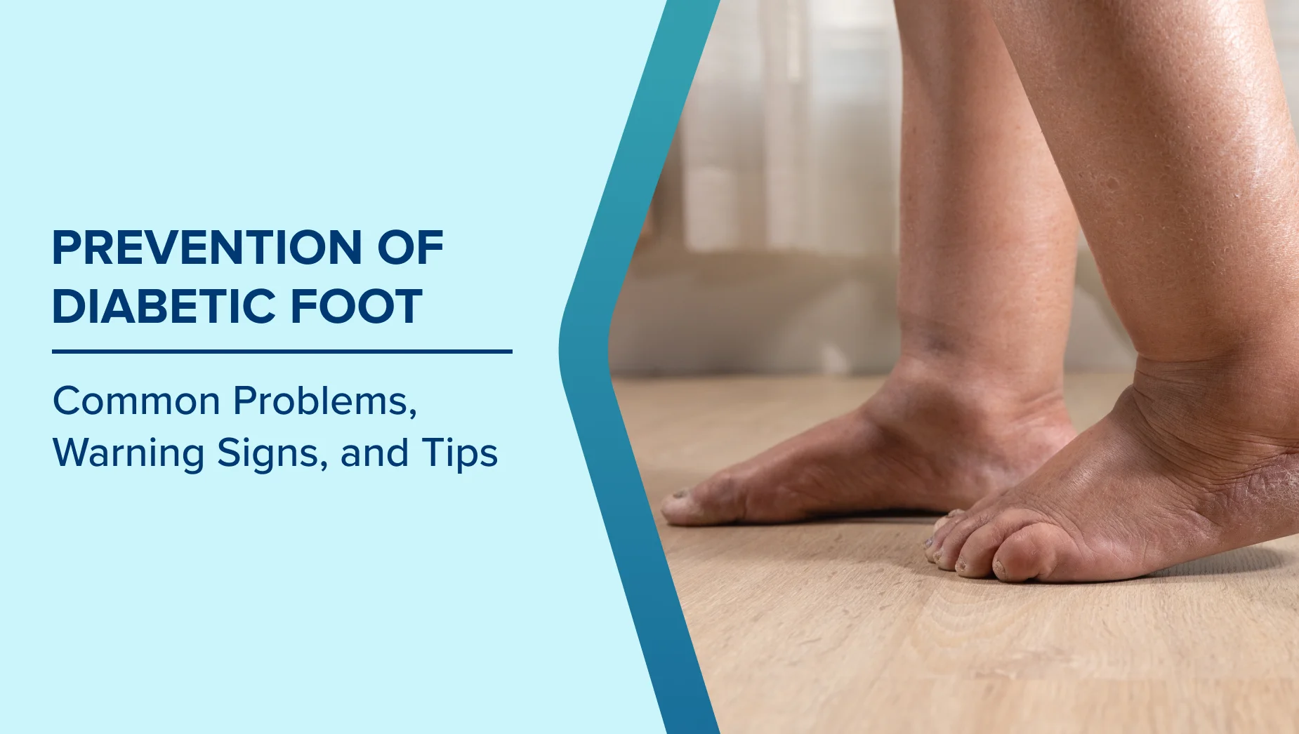 The Ultimate Guide: Prevention and Care of the Diabetic Foot